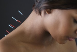 acupuncture neck pain st clair west forest hill toronto