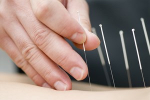 acupuncture for cancer pain st clair west toronto